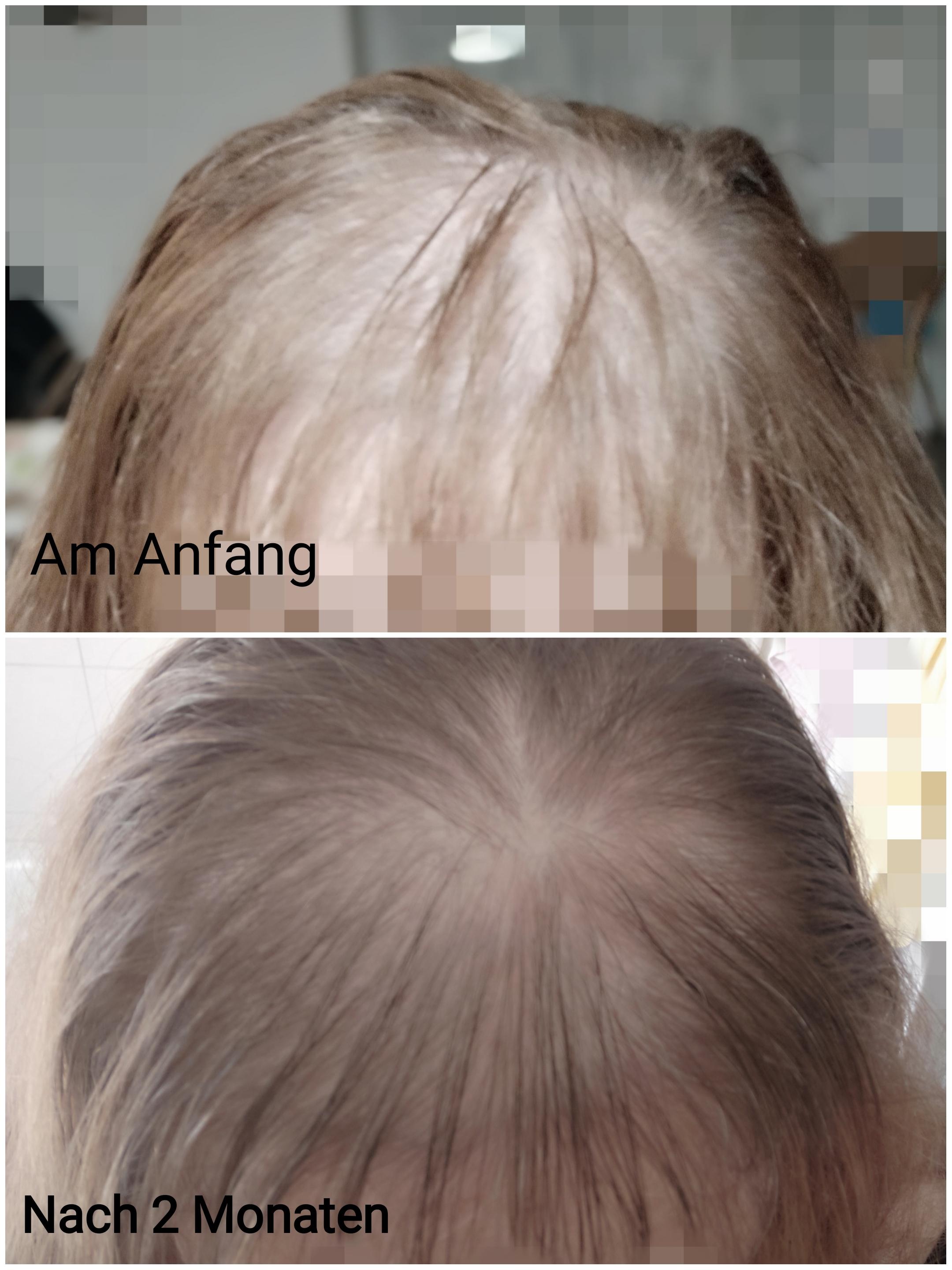 Weniger Haare im Abfluss